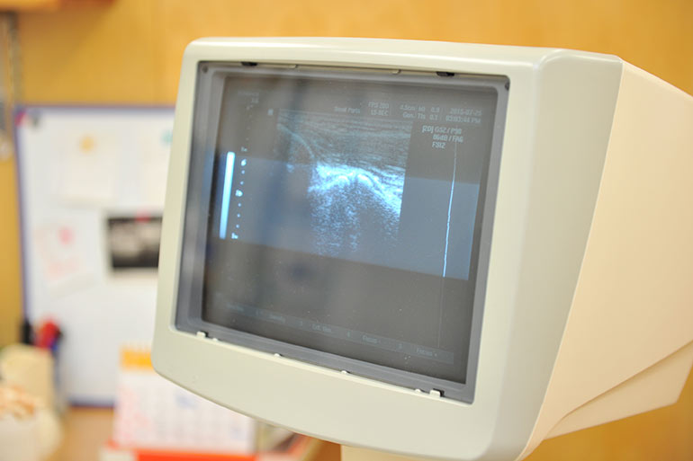 超音波エコーによる画像診断